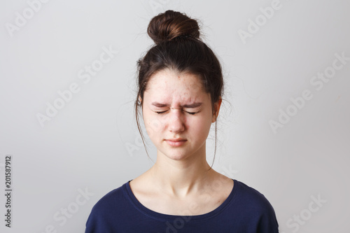 portrait of a pimply teenage girl in a blue T-shirt on a gray background,  with eyes closed
