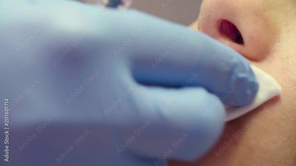 Close up. Doctor wiping solution the female lips in plastic surgery clinic.