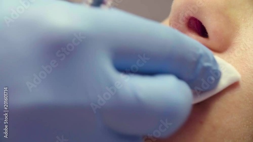 Close up. Doctor wiping solution the female lips in plastic surgery clinic.