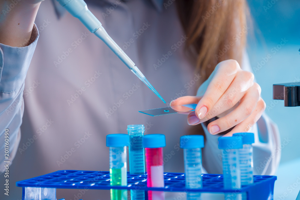 Blood sample on microscope slide. Researcher Analyzing Microscope Slide Blood sample on microscope slide. Researcher Analyzing Microscope Slide