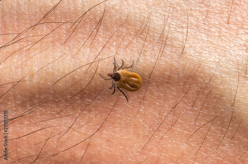 Tick is crawling on human body skin