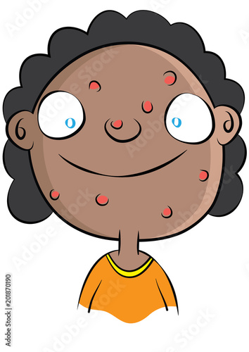cute black girl with acne problem