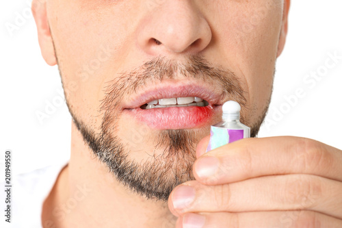 Man applying cream onto lips on white background, closeup