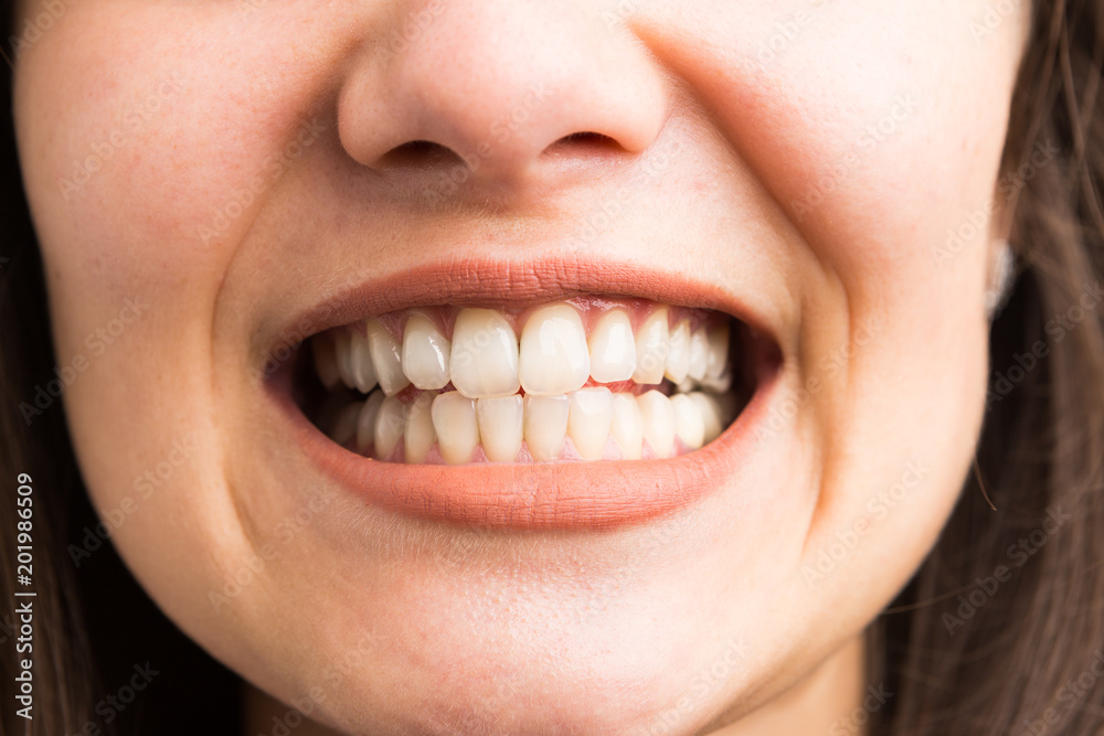 Young woman showing her teeth. Young woman showing her teeth.