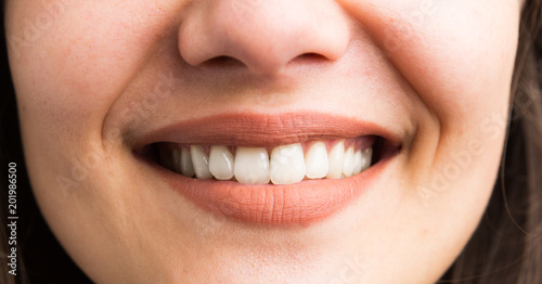 Close-up of female teeth smile.