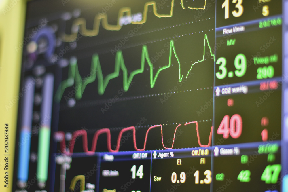 EKG monitor in intra aortic balloon pump machine in icu on blur ...