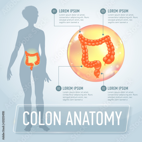 Vector colon infographics banner illustration photo