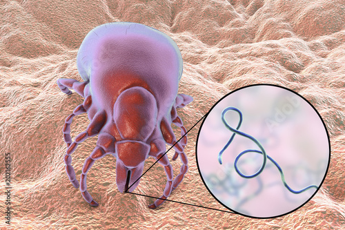 Lyme disease bacteria, Borrelia burgdorferi, transmitted by Ixodes tick, 3D illustration photo
