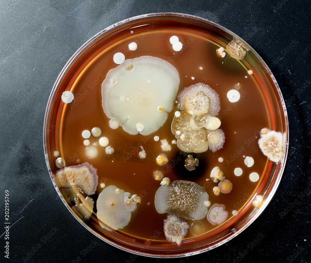 A petri dish with colonies of microorganisms for bacteriological analysis in a microbiological laboratory A petri dish with colonies of microorganisms for bacteriological analysis in a microbiological laboratory