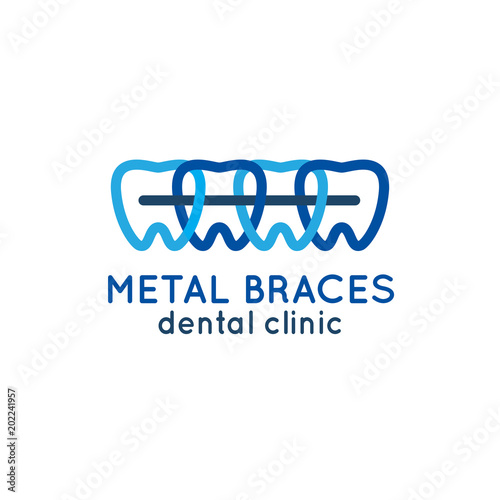 Cartoon teeth with metal braces. Vector illustration.