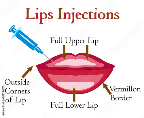 Lips injection vector illustration