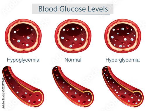 3 Different Blood Glucose Levels