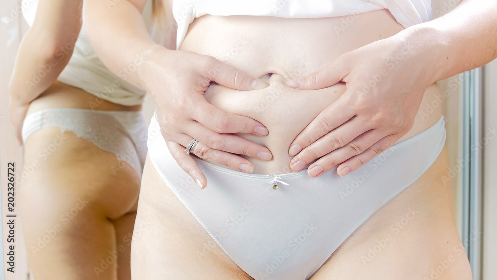 Closeup photo of young obese woman holding fat fold on her belly