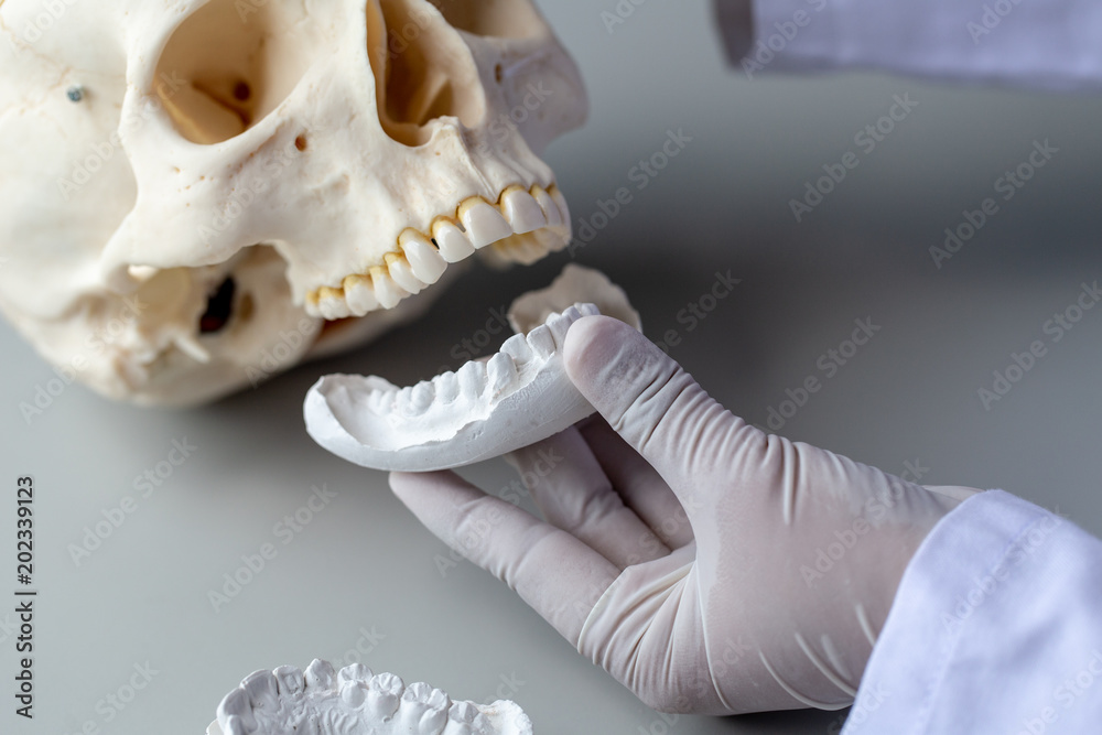 Study cast of Diagnostic cast and dental gypsum models in dental