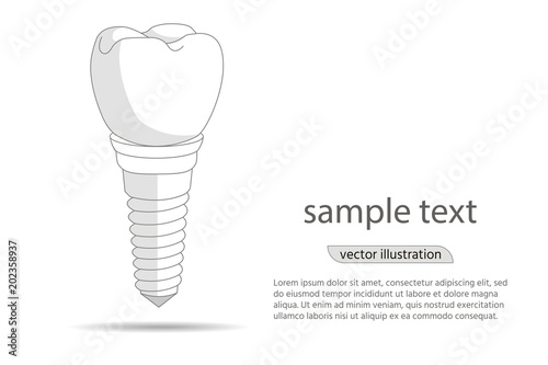 dental implant logo, icon. Implantation dentistry and care to teeth. illustration