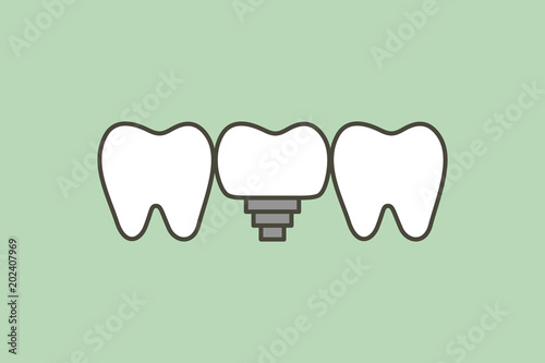 tooth implant, teeth change new root
