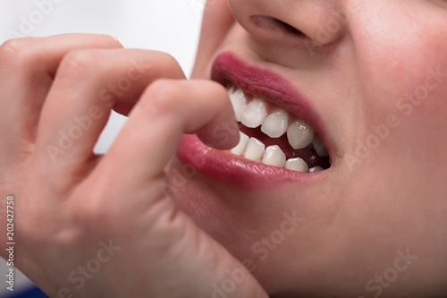 Businesswoman Biting Her Fingernail