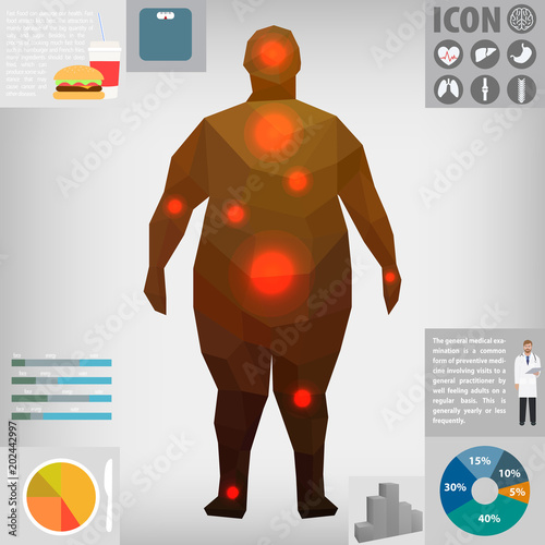 Obese people,  vector illustration