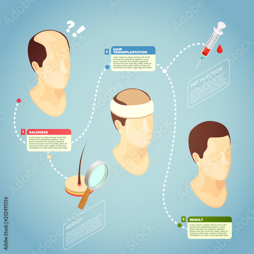 Hair Transplantation Vector Illustration