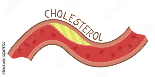 cholesterol illustration