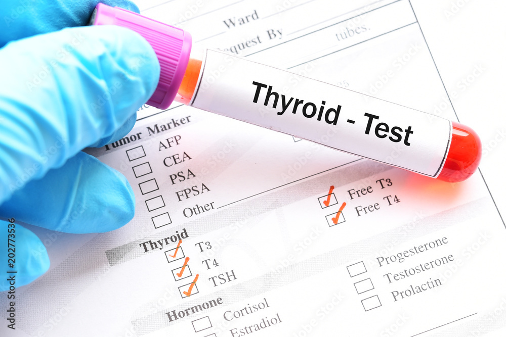 Obraz premium Blood sample for thyroid hormone test
