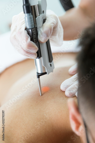The beautician s hands removing back hair with a laser to her client in the beauty salon.