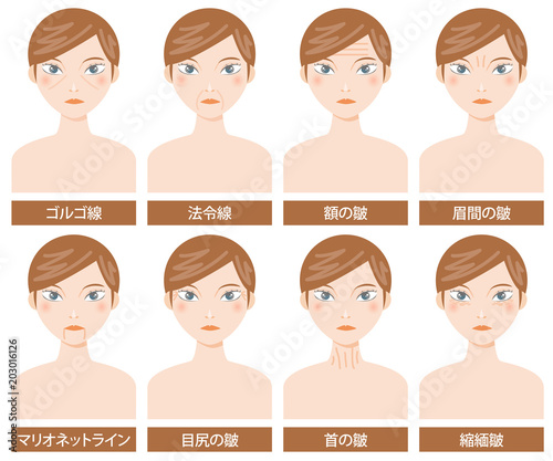 シワの種類　セット