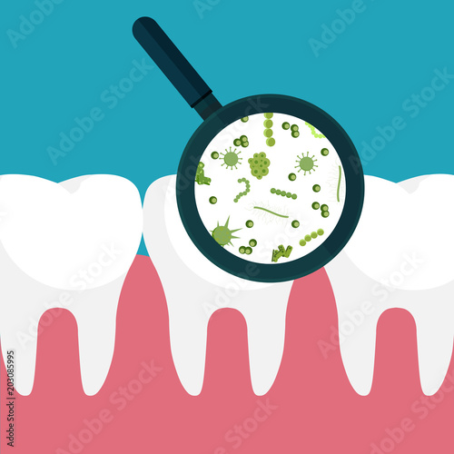 Bacteria on a human white tooth being viewed on a magnifying glass. Vector illustration