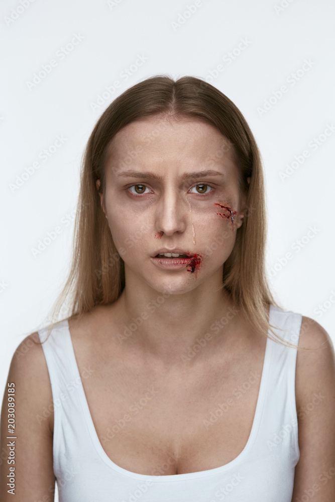 Domestic Violence. Woman With Beating On Face Domestic Violence. Woman With Beating On Face