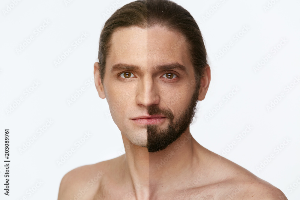 Shaving. Man With And Without Hair On Face Shaving. Man With And Without Hair On Face
