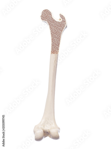 Fotografie 3d rendered, medically accurate illustration of osteoporosis