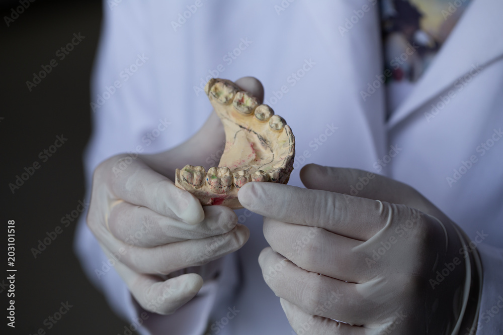 Study cast of Diagnostic cast and dental gypsum models in dental