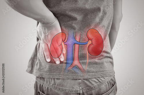 Canvastavla Man kidney failure, Renal failure against gray background