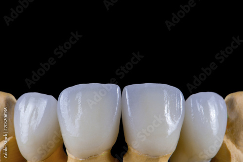 Ceramic teeth