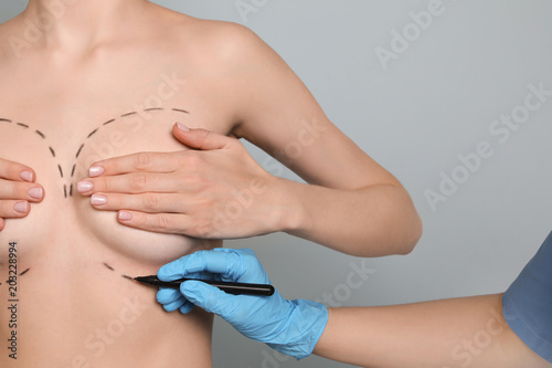 Fototapeta Doctor drawing marks on female breast for cosmetic surgery operation against col