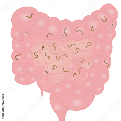 helminths in  intestine