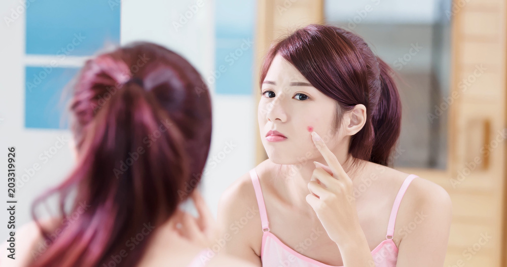 woman with acne problem woman with acne problem