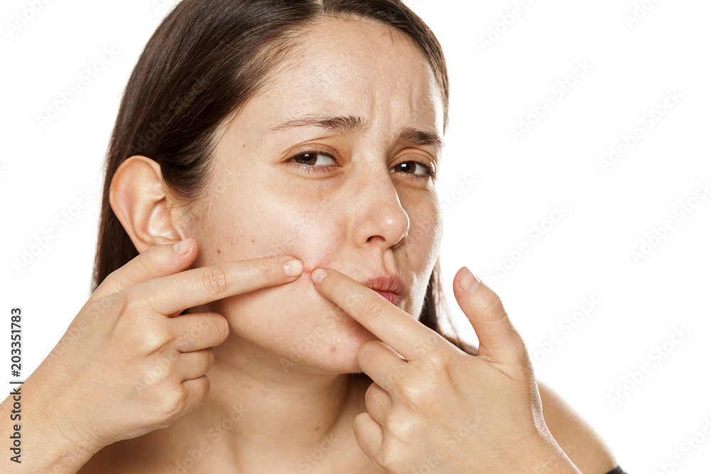 Young woman sqeezing a pimple on her cheek on white background Young woman sqeezing a pimple on her cheek on white background