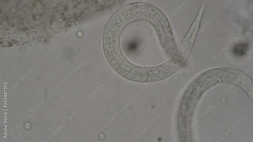 parasite : Strongyloides stercoralis from human feces under microscope. testing in laboratory