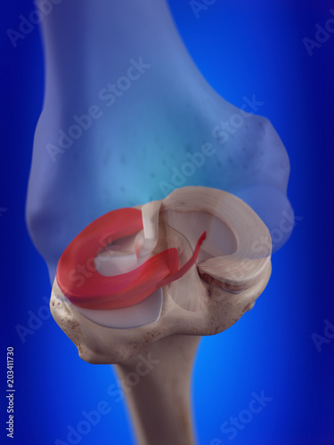 3d rendered, medically accurate illustration of the lateral meniscus