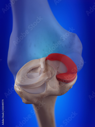 3d rendered, medically accurate illustration of the medial meniscus photo