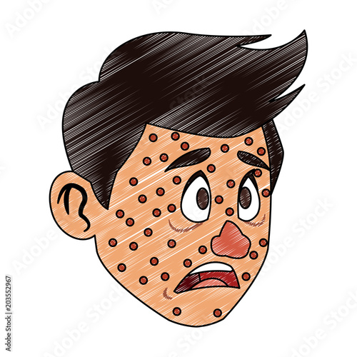 Man face with chickenpox vector illustration graphic design