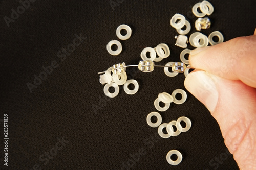 Fingers hold metal braces and elastic bands for braces on black background. Dental concept photo