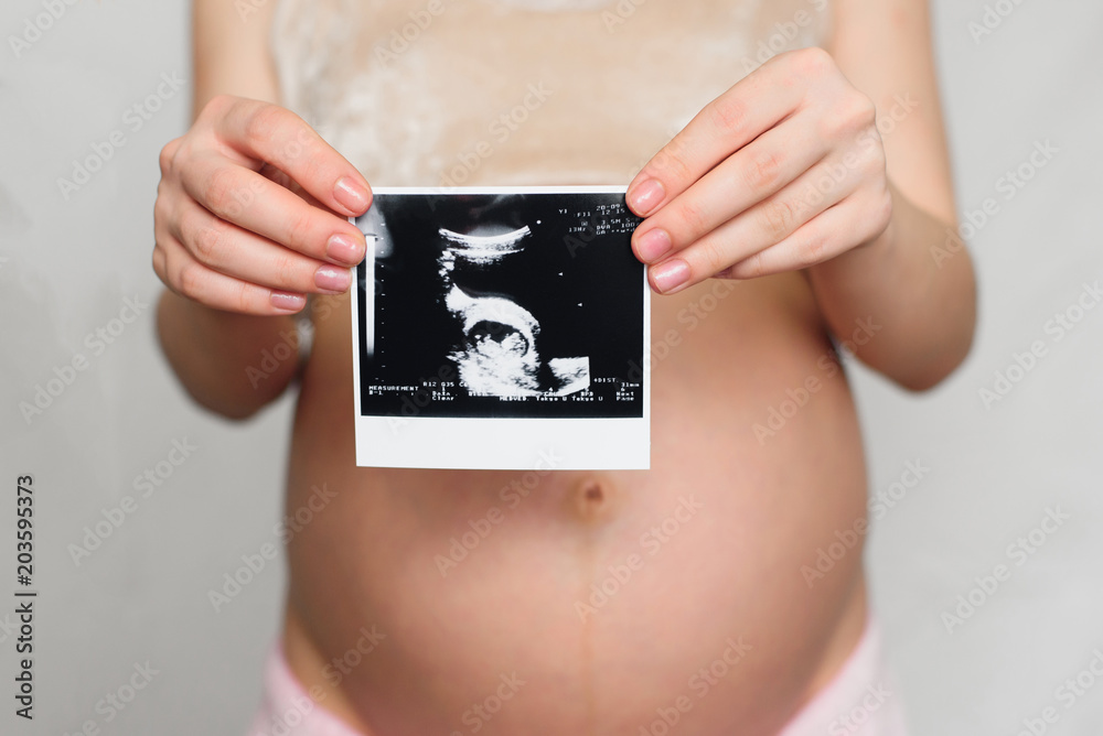 photo of a pregnant ultrasound in the hands of a pregnant girl on the background of the abdomen photo of a pregnant ultrasound in the hands of a pregnant girl on the background of the abdomen