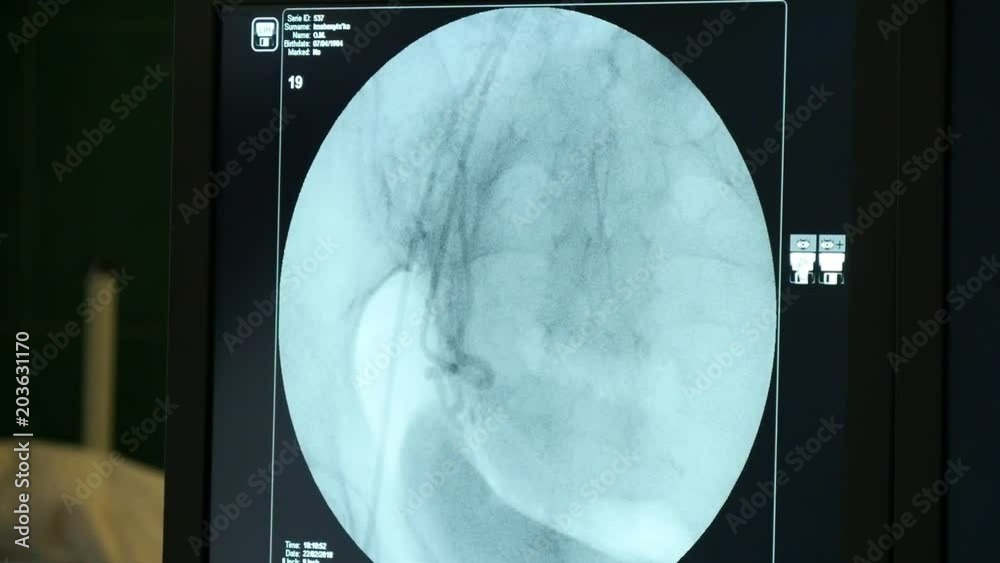 Closeup of a modern X-ray with a big display in the black backdrop ...