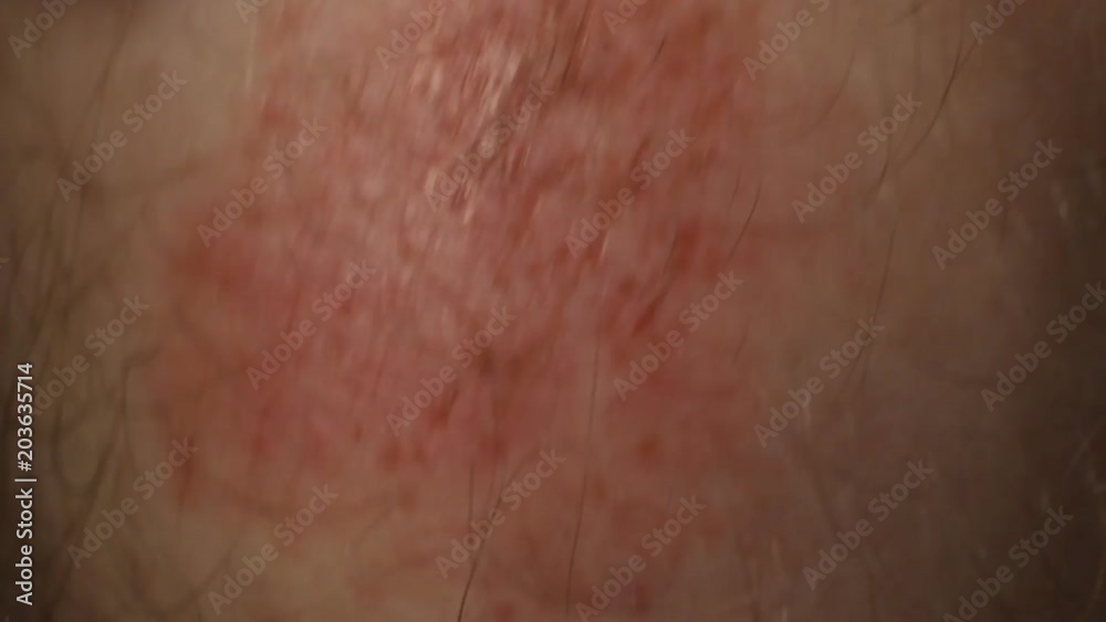 scrape on the knee, close-up, touch scrape on the knee, close-up, touch
