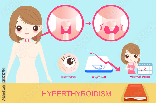 woman with hyperthyroidism