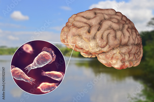 Brain-eating amoeba infection, naegleriasis. Trophozoite form of the parasite Naegleria fowleri and brain encephalitis caused by amoeba, 3D illustration