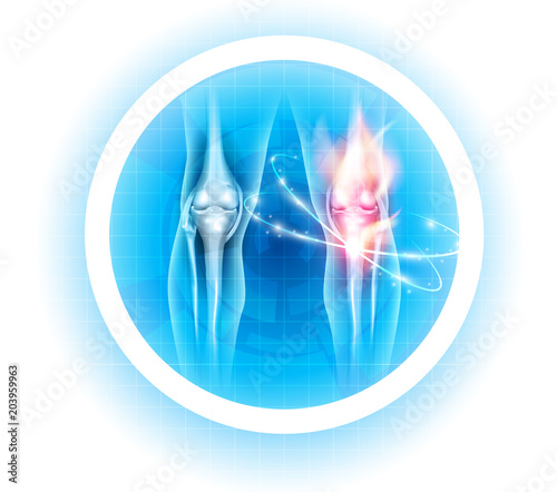 Joint problems symbol, transparent legs with joints and fire on a beautiful light blue background