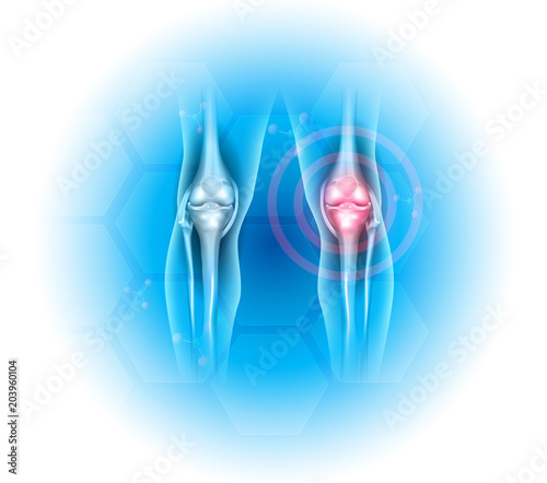 Joint problems illustration, transparent legs with joints on a beautiful light blue background